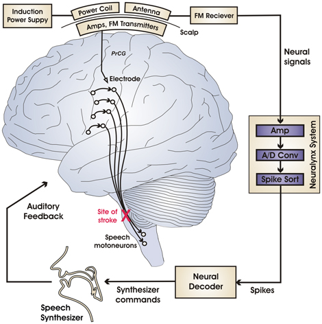 brain470